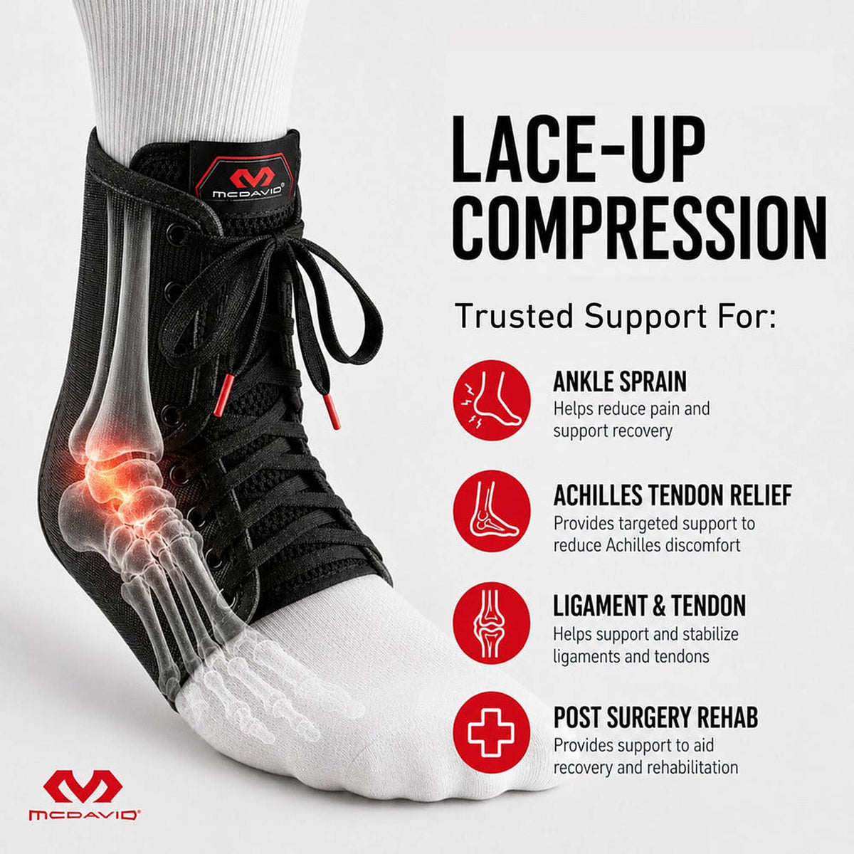 Šnurovacia ortéza na členok McDavid 199 Ankle Brace Lace-Up with Stays čierna